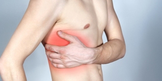 intercostal neuralgia